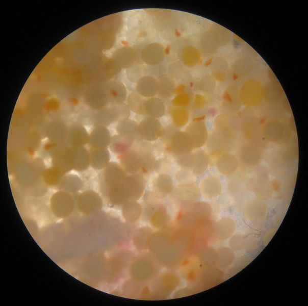 Fil:Crucian carp-eggs microscope.jpg